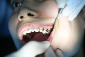 Máster Universitario en Estética Dental y Odontología Restauradora de UAX Universidad Alfonso X El Sabio