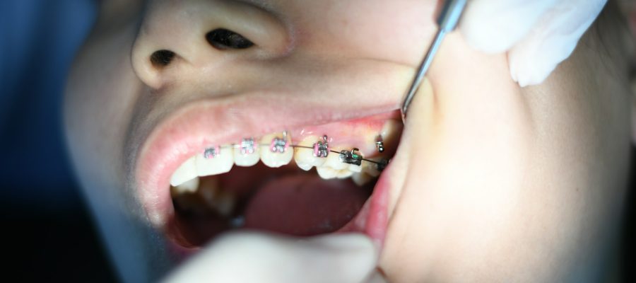 photo-1598256989809-394fa4f6cd26 Máster Universitario en Estética Dental y Odontología Restauradora de UAX Universidad Alfonso X El Sabio